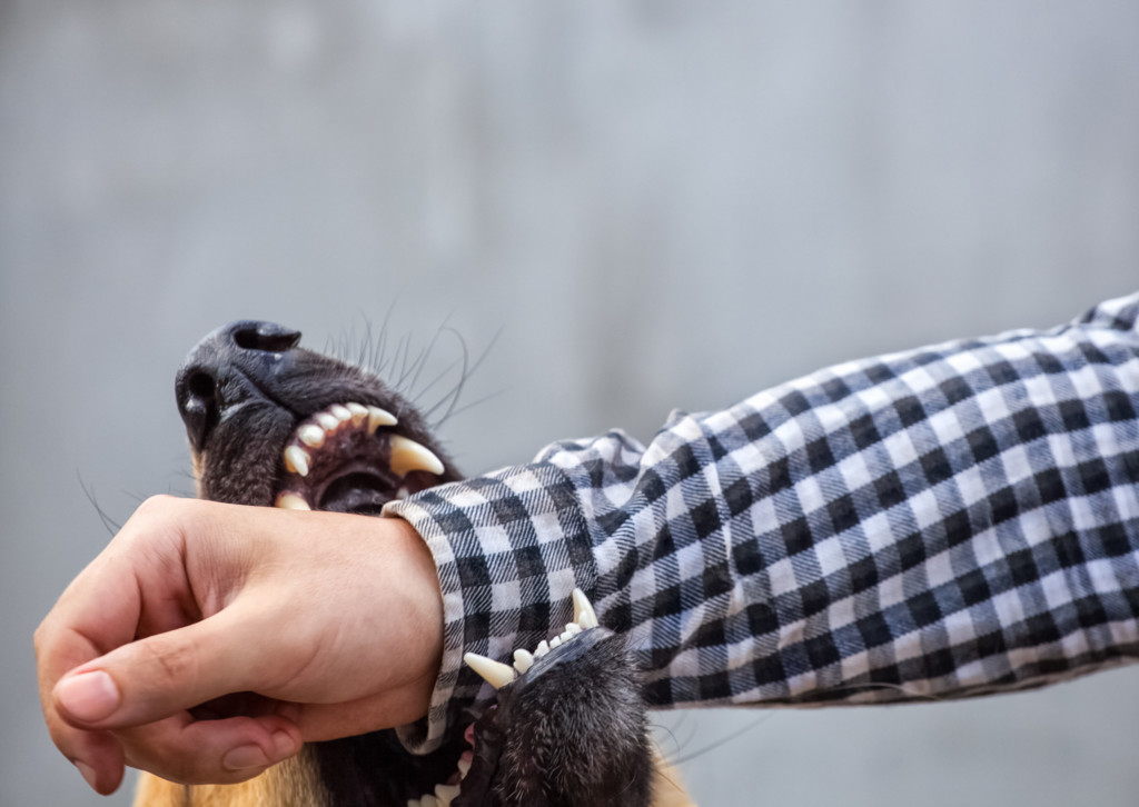 Dog biting man's arm
